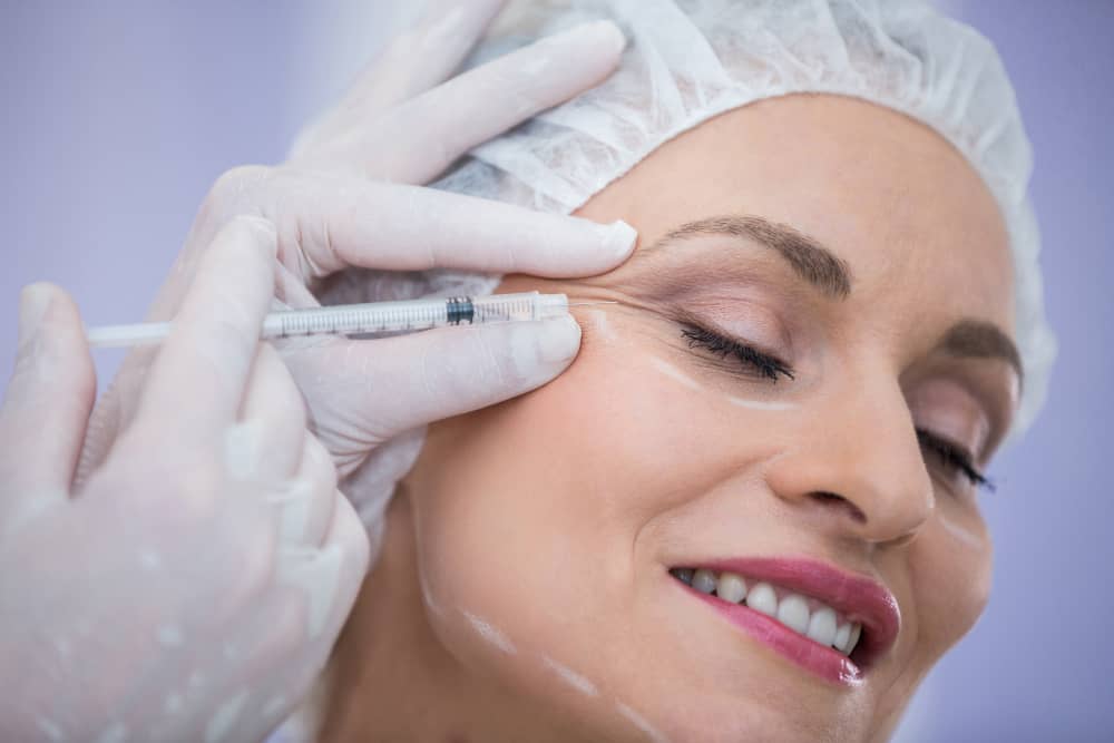 botox for crows feet